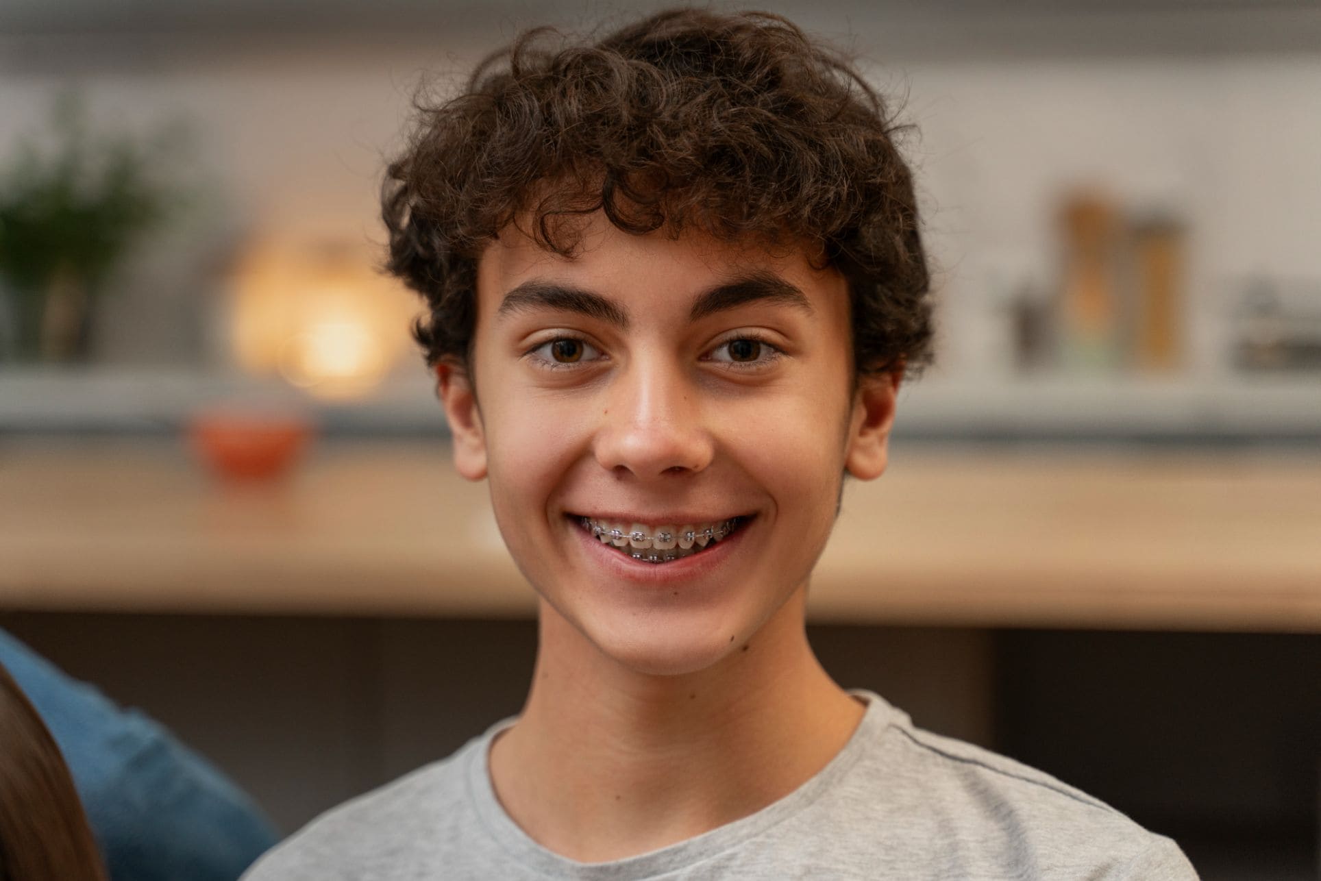 Do Teens with Braces need Mouthguards?